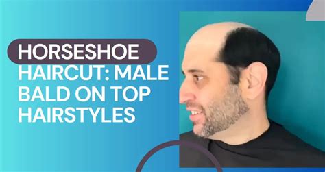 horse haircut on man|horseshoe haircut for men.